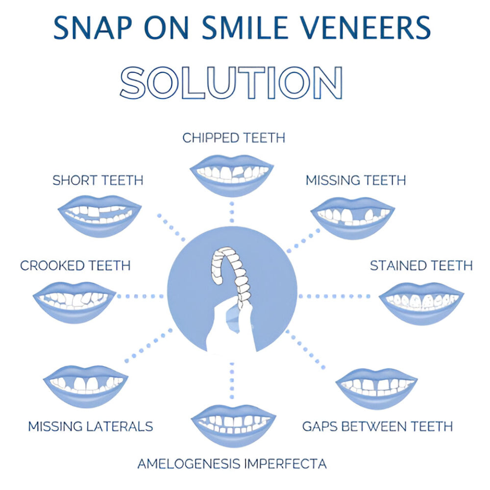 Teeth Veneer Cosmetic Cover Set Smile